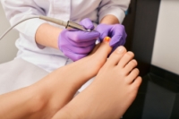 Advantages and Drawbacks of Laser Treatment for Toenail Fungus
