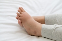 What Can Help Swollen Feet?