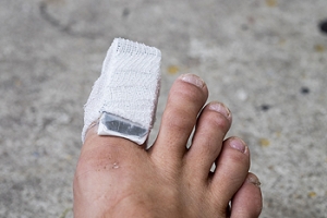 Children and Broken Toes