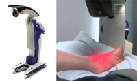 MLS Laser Treatment for Tendon Pain