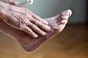Causes and Remedies of Poor Foot Circulation