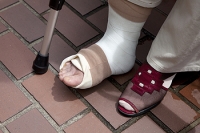 Tips on How to Prevent Falls Among the Elderly