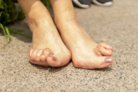 The Impact of Rheumatoid Arthritis on Feet