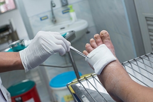 Diabetes and Wound Care
